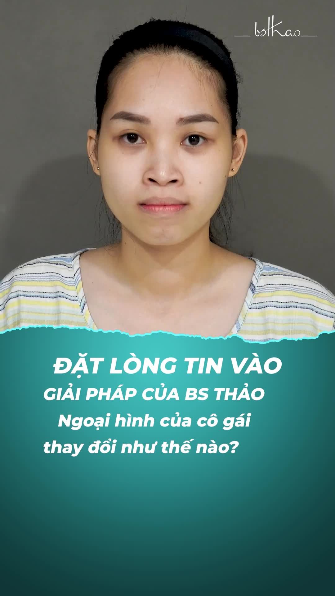 TIN VÀO GIẢI PHÁP BÁC SĨ CỦA DIVA TƯ VẤN - NGOẠI HÌNH CÔ GÁI THAY ĐỔI RA SAO SAU THẨM MỸ?